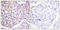 G Protein-Coupled Receptor Kinase 2 antibody, LS-C199026, Lifespan Biosciences, Immunohistochemistry paraffin image 