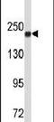 DNA Topoisomerase II Alpha antibody, PA5-26255, Invitrogen Antibodies, Western Blot image 