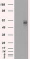 Fyn Related Src Family Tyrosine Kinase antibody, M04075-1, Boster Biological Technology, Western Blot image 