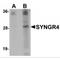 Synaptogyrin 4 antibody, MBS150521, MyBioSource, Western Blot image 