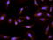 Cytochrome P450 Family 26 Subfamily A Member 1 antibody, LS-B4140, Lifespan Biosciences, Immunocytochemistry image 