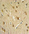 ST8 Alpha-N-Acetyl-Neuraminide Alpha-2,8-Sialyltransferase 4 antibody, 64-105, ProSci, Immunohistochemistry paraffin image 