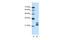 Cold Shock Domain Containing C2 antibody, ARP40768_T100, Aviva Systems Biology, Western Blot image 