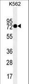 Transglutaminase 2 antibody, LS-C161837, Lifespan Biosciences, Western Blot image 