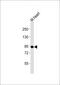 Ubiquitin Like With PHD And Ring Finger Domains 1 antibody, MBS9209834, MyBioSource, Western Blot image 