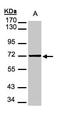 Mesothelin antibody, LS-C185706, Lifespan Biosciences, Western Blot image 