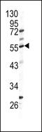 Glutamic--Pyruvic Transaminase antibody, LS-C100675, Lifespan Biosciences, Western Blot image 