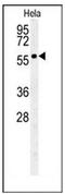 Polypeptide N-Acetylgalactosaminyltransferase 4 antibody, AP51769PU-N, Origene, Western Blot image 