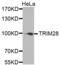 Tripartite Motif Containing 28 antibody, abx001832, Abbexa, Western Blot image 