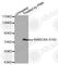 Myristoylated Alanine Rich Protein Kinase C Substrate antibody, AP0403, ABclonal Technology, Western Blot image 