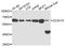 Zinc Finger CCCH-Type Containing 15 antibody, STJ112085, St John