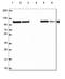 Glucosidase II Alpha Subunit antibody, NBP2-49332, Novus Biologicals, Western Blot image 