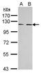 EPH Receptor A3 antibody, PA5-29904, Invitrogen Antibodies, Western Blot image 