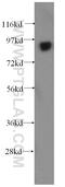 Component Of Oligomeric Golgi Complex 3 antibody, 11130-1-AP, Proteintech Group, Western Blot image 