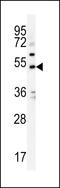 Potassium Voltage-Gated Channel Subfamily J Member 6 antibody, LS-C165435, Lifespan Biosciences, Western Blot image 