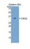 Solute Carrier Family 17 Member 5 antibody, abx102209, Abbexa, Western Blot image 