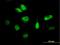 Cyclin Dependent Kinase Inhibitor 3 antibody, H00001033-B02P, Novus Biologicals, Immunocytochemistry image 
