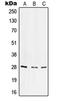 Integrin Subunit Alpha 6 antibody, LS-C352400, Lifespan Biosciences, Western Blot image 