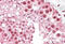 MutS protein homolog 5 antibody, MBS421946, MyBioSource, Immunohistochemistry frozen image 