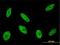 Cyclin Dependent Kinase Like 1 antibody, H00008814-M01, Novus Biologicals, Immunocytochemistry image 