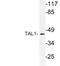 TAL BHLH Transcription Factor 1, Erythroid Differentiation Factor antibody, LS-C177803, Lifespan Biosciences, Western Blot image 