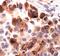 Insulin Like Growth Factor Binding Protein 2 antibody, PA5-17699, Invitrogen Antibodies, Immunohistochemistry frozen image 