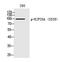 Kinesin Family Member 20A antibody, PA5-40224, Invitrogen Antibodies, Western Blot image 