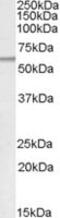 Patatin Like Phospholipase Domain Containing 2 antibody, MBS420222, MyBioSource, Western Blot image 