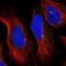 McKusick-Kaufman Syndrome antibody, NBP1-92123, Novus Biologicals, Immunofluorescence image 