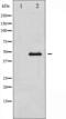 Adrenoceptor Beta 2 antibody, abx012123, Abbexa, Western Blot image 