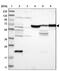 Junctophilin 1 antibody, PA5-52639, Invitrogen Antibodies, Western Blot image 