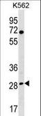 Replication Protein A4 antibody, LS-C158883, Lifespan Biosciences, Western Blot image 