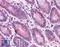 Synaptogyrin-2 antibody, LS-B5070, Lifespan Biosciences, Immunohistochemistry paraffin image 