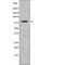 Ribosomal Protein S6 Kinase A2 antibody, abx218378, Abbexa, Western Blot image 