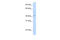 Cytochrome C Oxidase Assembly Factor Heme A:Farnesyltransferase COX10 antibody, 26-032, ProSci, Western Blot image 