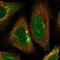 Transcription Factor AP-2 Alpha antibody, NBP1-90143, Novus Biologicals, Immunofluorescence image 