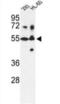 Cytochrome P450 Family 21 Subfamily A Member 2 antibody, abx033740, Abbexa, Western Blot image 