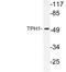 Tryptophan Hydroxylase 1 antibody, LS-C176562, Lifespan Biosciences, Western Blot image 