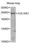 Collagen Type XVIII Alpha 1 Chain antibody, MBS127948, MyBioSource, Western Blot image 