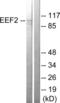 Eukaryotic Translation Elongation Factor 2 antibody, LS-B7556, Lifespan Biosciences, Western Blot image 