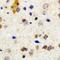 ADP-Ribosyltransferase 5 antibody, LS-C668909, Lifespan Biosciences, Immunohistochemistry paraffin image 