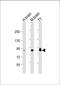 Doublecortin Like Kinase 1 antibody, M03089-1, Boster Biological Technology, Western Blot image 