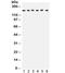 Rho Associated Coiled-Coil Containing Protein Kinase 2 antibody, R31832, NSJ Bioreagents, Western Blot image 