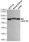 Lamin B2 antibody, STJ99315, St John