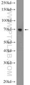 Activator Of Transcription And Developmental Regulator AUTS2 antibody, 25001-1-AP, Proteintech Group, Western Blot image 