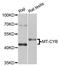 Malonyl-CoA-Acyl Carrier Protein Transacylase antibody, STJ111820, St John