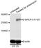 BRCA1 DNA Repair Associated antibody, STJ22043, St John