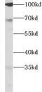 Ferroportin-1 antibody, FNab10500, FineTest, Western Blot image 