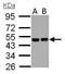 Regulator Of Chromosome Condensation 1 antibody, GTX104590, GeneTex, Western Blot image 