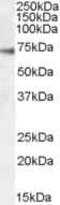 Gamma-Aminobutyric Acid Type A Receptor Alpha4 Subunit antibody, PA5-19061, Invitrogen Antibodies, Western Blot image 